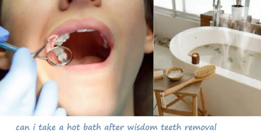 Can I Take a Hot Bath After Tooth Extraction? Understanding the Basics