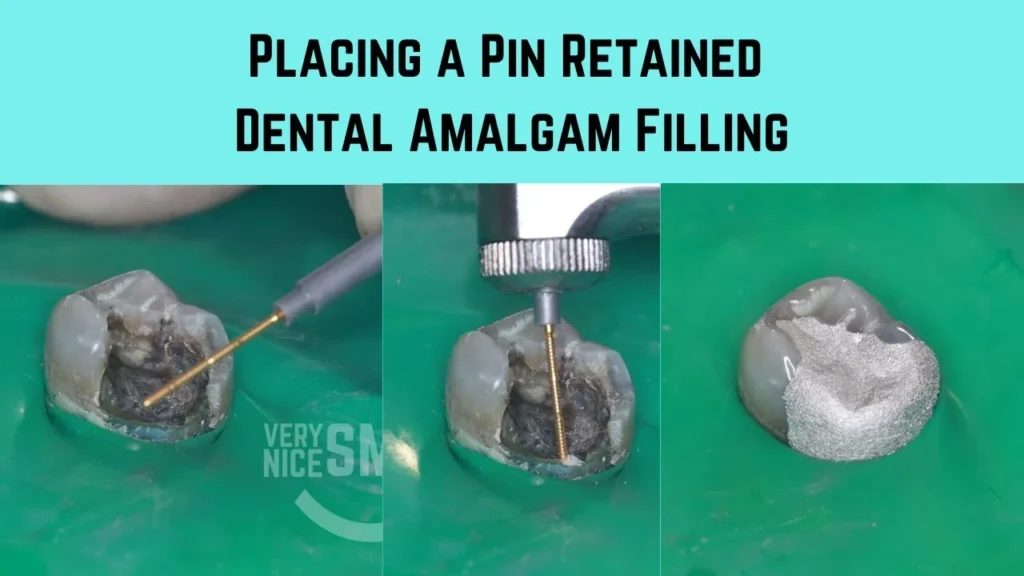 Deep Cleaning and Restoration