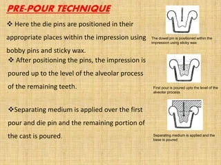 Gentle Techniques for Separating the Front