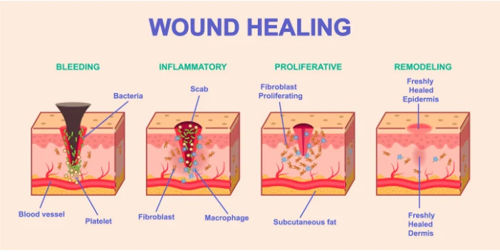 Healing Process and Why Temperature Matters