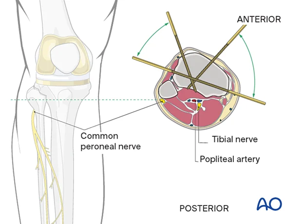 Strategic placement: Functional zones enhanced by woven baskets