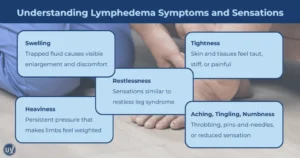 Understanding Lymphedema and Its Impact on Seating
