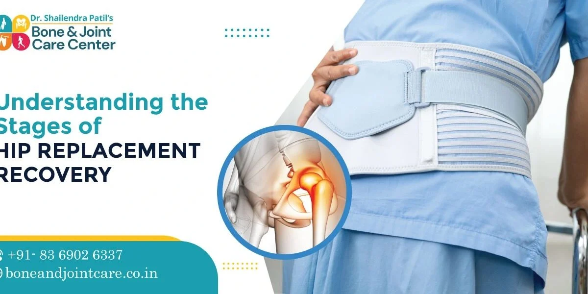 Understanding Hip Replacement Recovery Needs
